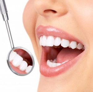 Pose de facettes dentaires : temps et efficacité