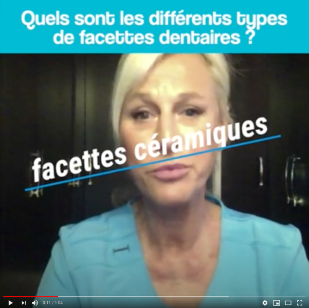 types facettes dentaires